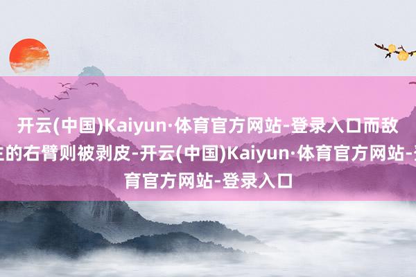 开云(中国)Kaiyun·体育官方网站-登录入口而敌东说念主的右臂则被剥皮-开云(中国)Kaiyun·体育官方网站-登录入口